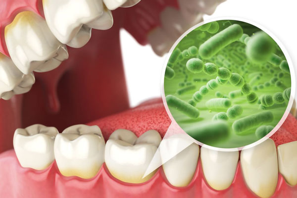شناخت انواع باکتری‌های دهان -- راهنمای تنظیم باکتری‌های مفید و مضر دهان